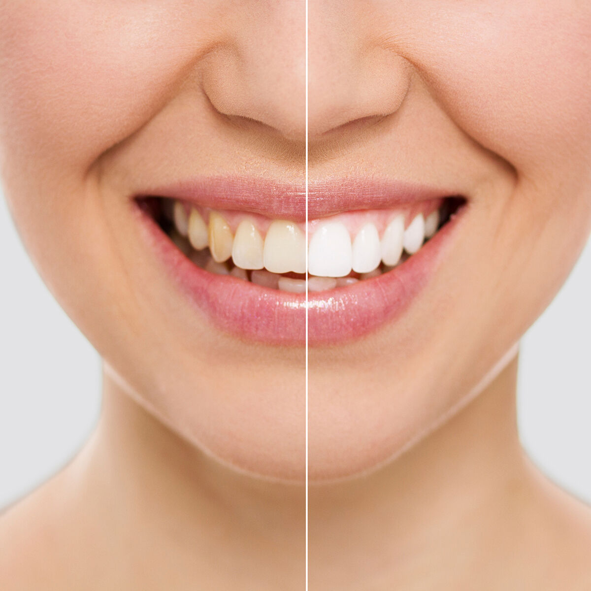 Tooth Whitening Pencil